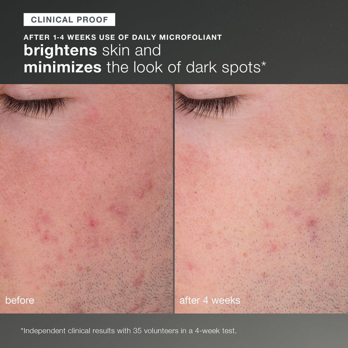 discover healthy skin kit